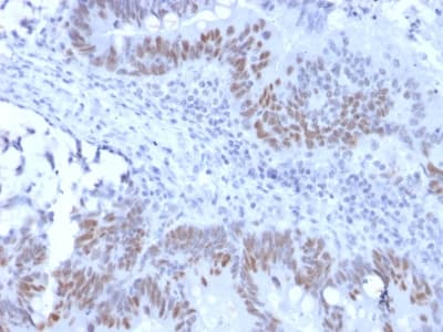 RB1 / Retinoblastoma / RB Antibody (clone RB1/2313R)