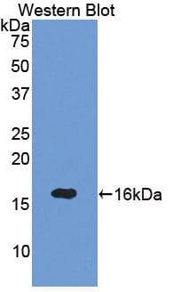 PathPlus™ SEMA3A / Semaphorin 3A Antibody (aa31-141)