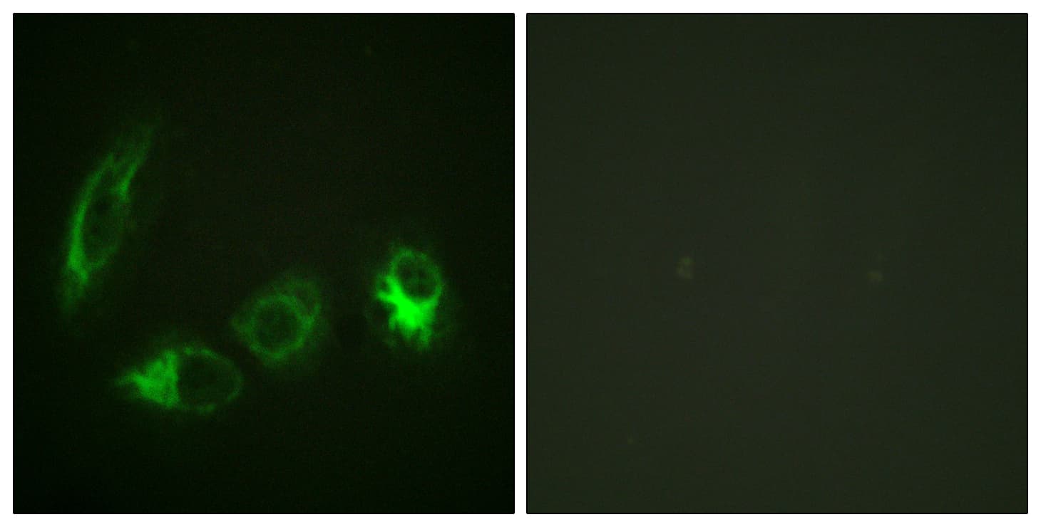 IRS1 Antibody (phospho-Ser323)
