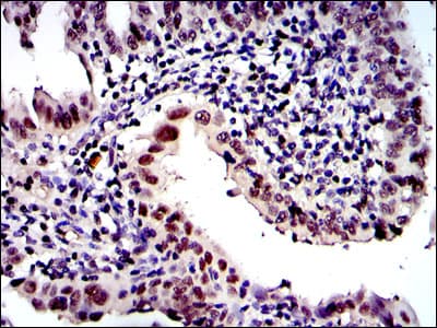 PSMB8 / LMP7 Antibody (clone 1A5)