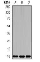MSRB2 / MSRB Antibody
