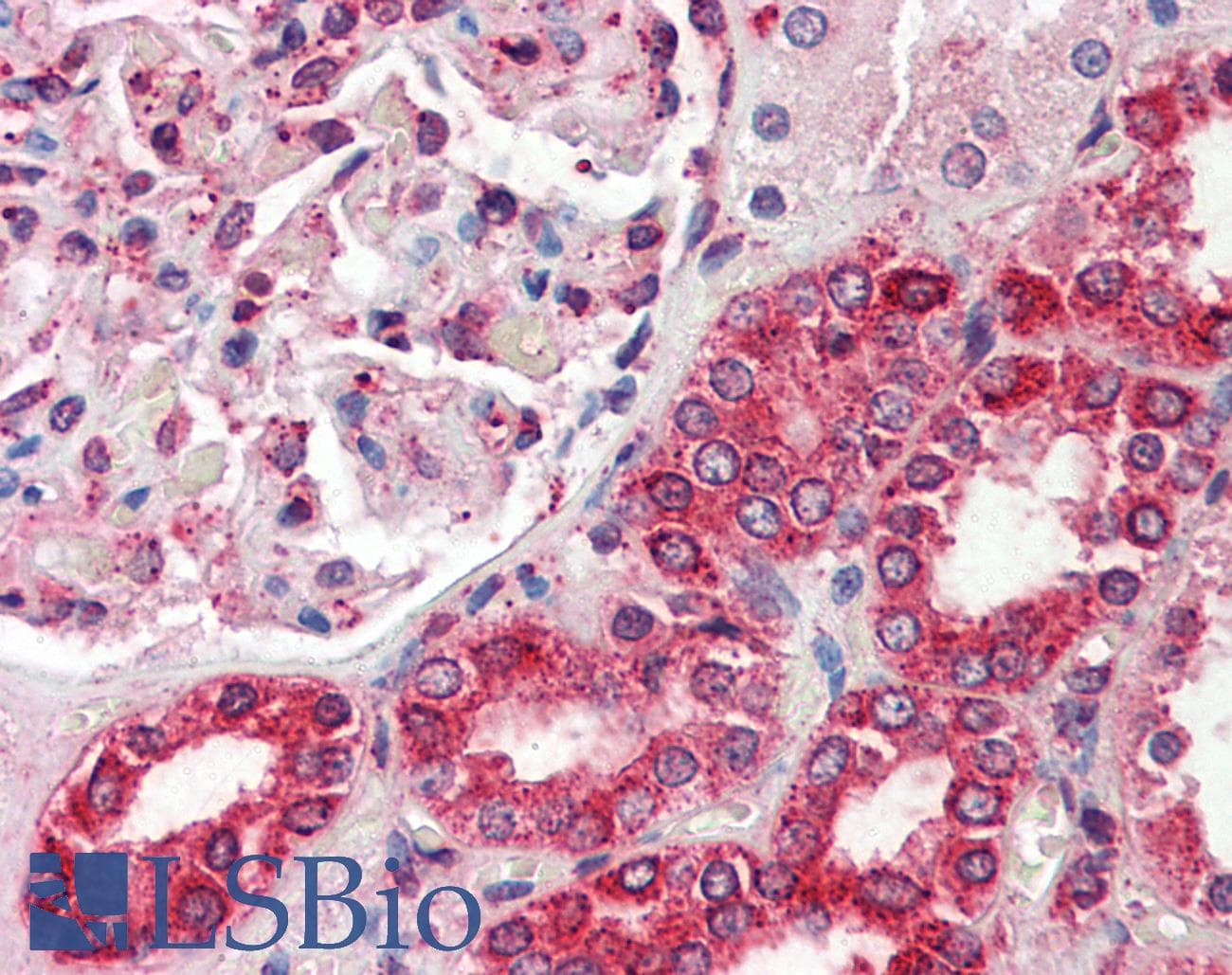 IHC-plus™ CALR / Calreticulin Antibody