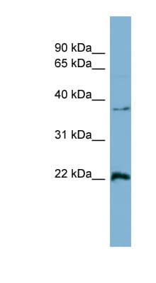 RAN Antibody (aa143-192)