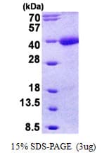 Human TMEFF1 / Tomoregulin 1 Protein (Recombinant His)