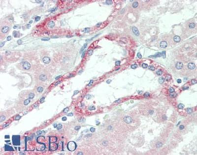 IHC-plus™ CLDN10 / Claudin 10 Antibody