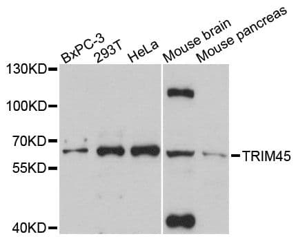 TRIM45 Antibody