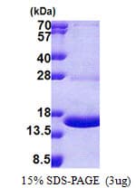 Human MPZL1 Protein (Recombinant His)