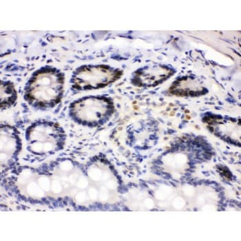 CDK4 Antibody (aa201-303)
