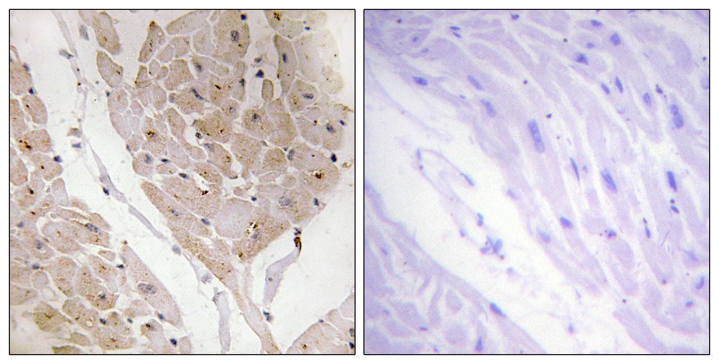 LGALS2 / Galectin 2 Antibody