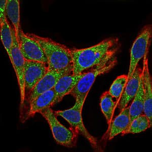 IHC-plus™ PIK3R1 / p85 Alpha Antibody (clone 6G10)