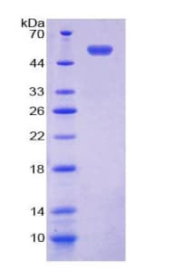 Human NUP153 Protein (Recombinant His-GST)