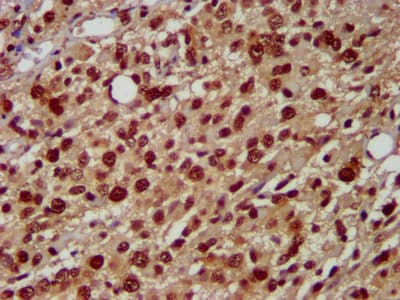HNRNPAB Antibody
