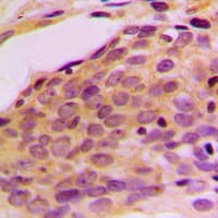 MPRIP / RIP3 Antibody (Internal)