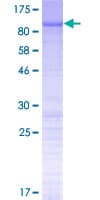 Human N4BP2L2 Protein (Recombinant GST)
