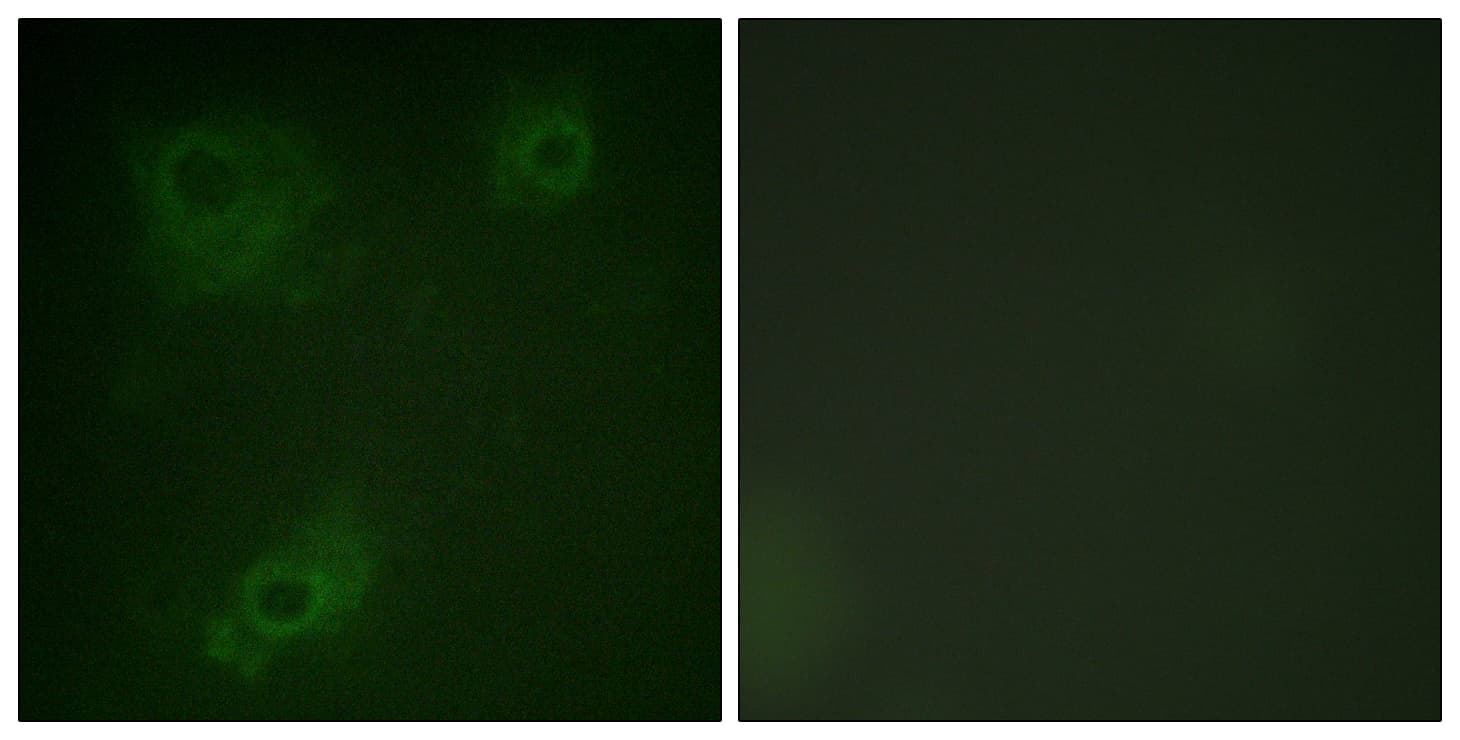 IHC-plus™ IRS1 Antibody (aa289-338)