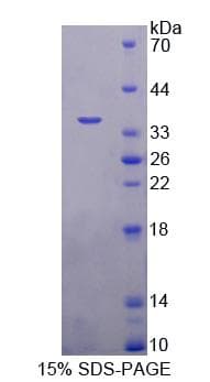 Human MBD2 Protein (Recombinant 6His, N-terminus)