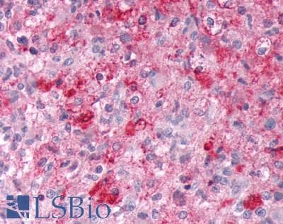 PathPlus™ ADGRE2 / EMR2 Antibody (N-Terminus)