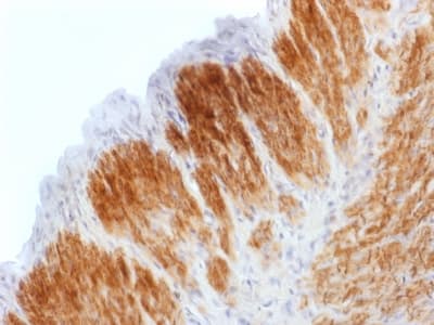 CNN1 / Calponin Antibody (clone CNN1/1408R)