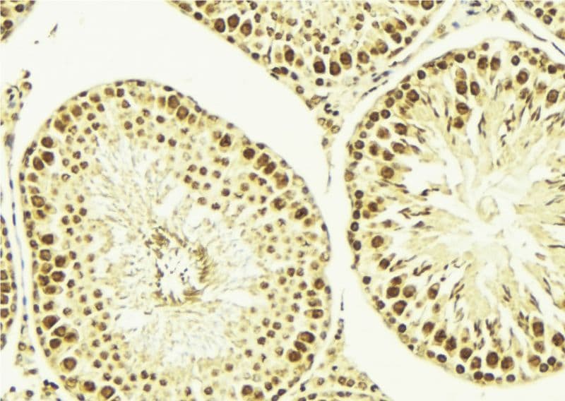 ELK1 Antibody