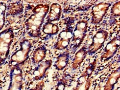Polyclonal Rabbit anti-Human C-TAK1 / MARK3 Antibody (IHC, IF)