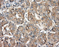 BTK Antibody (clone OTI3A2)