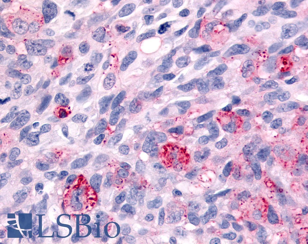 PathPlus™ Polyclonal Rabbit anti-Human WNK1 Antibody (Internal, IHC)