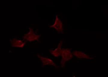 IL15RA Antibody