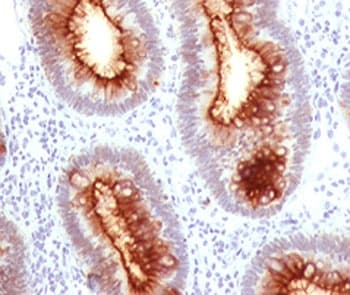 CEACAM5 / CD66e Antibody (clone C66/1030)