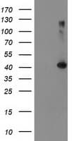 TBC1D21 Antibody (clone OTI7G10)
