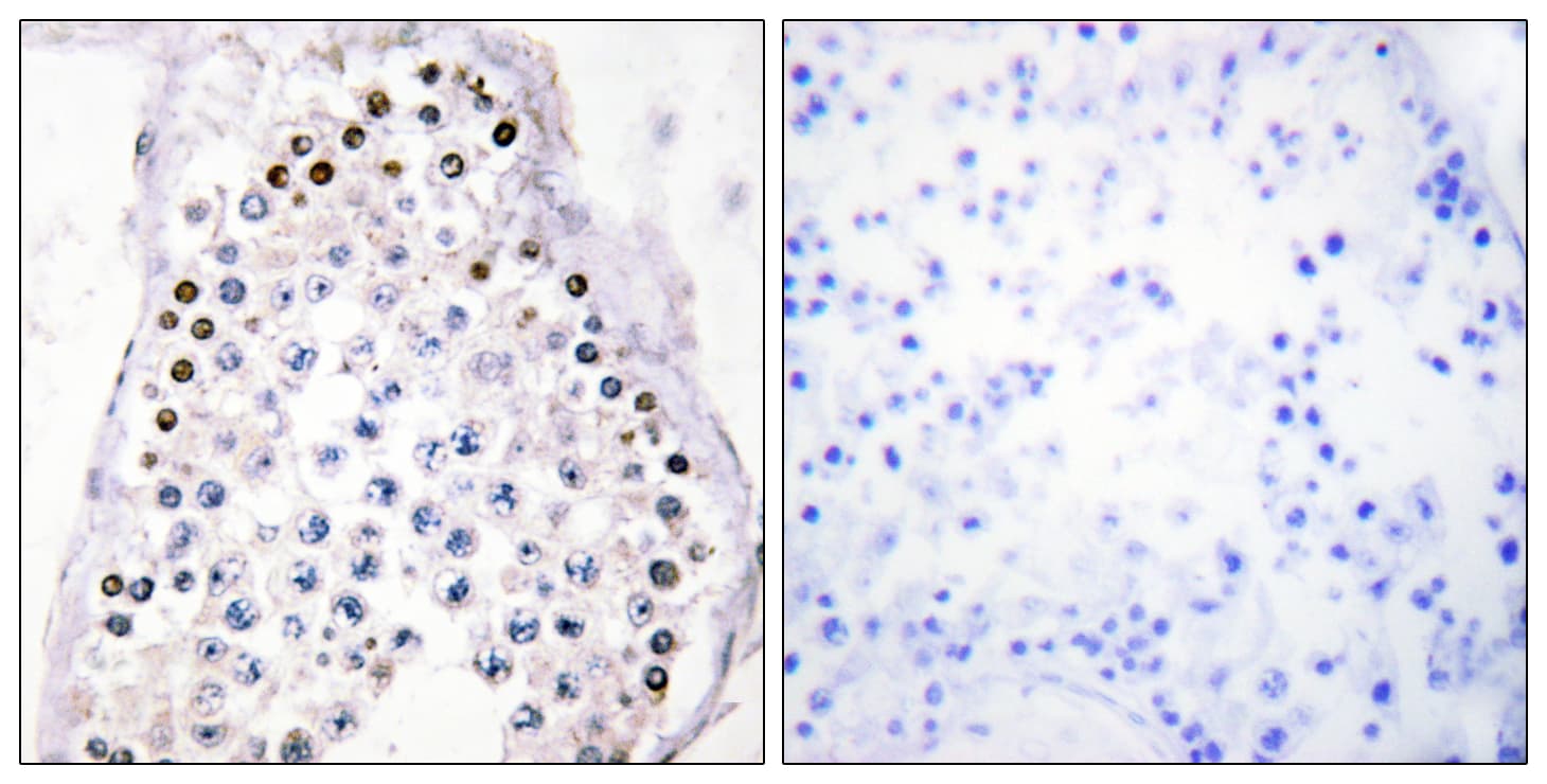 Polyclonal Rabbit anti-Human HOXA1/HOXB1/HOXD1 Antibody (C-Terminus, IHC)