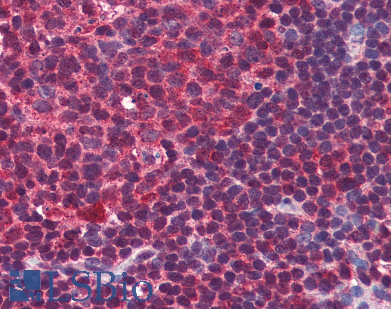 IHC-plus™ BLIMP1 / PRDM1 Antibody