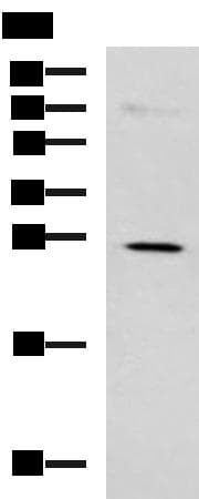 NQO2 Antibody