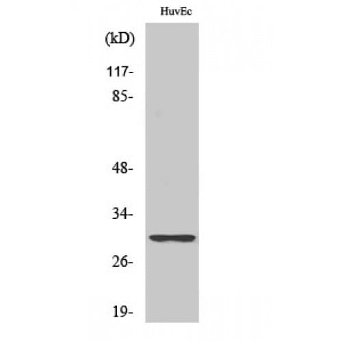 RPS4X + RPS4Y1 + RPS Antibody (190-270 aa, C-terminal)