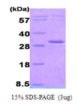 Human AK3 / Adenylate Kinase 3 Protein (Recombinant His)