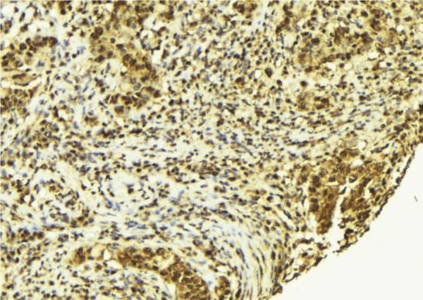 Polyclonal Rabbit anti-Human ACTN4 Antibody (IHC, WB)
