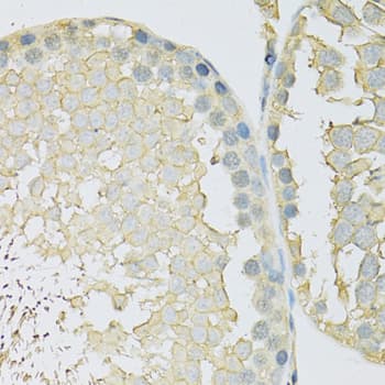 SLC2A9 / GLUT9 Antibody