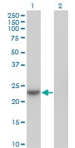 NME6 Antibody (clone 2A10)