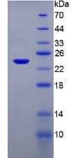 Mouse MAP3K7CL / TAK1L Protein (Recombinant His-T7)
