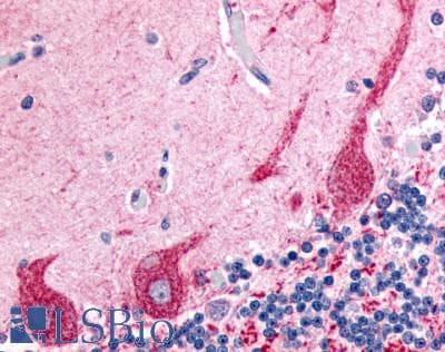 PathPlus™ Polyclonal Rabbit anti-Human PRKCZ / PKC-Zeta Antibody (N-Terminus, IHC)