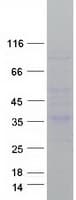 Human CRHBP Protein (Recombinant Myc-DDK (Flag))