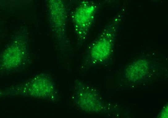 SERPINB3 Antibody (clone OTI3G4)