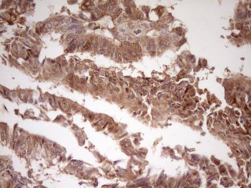 IHC-plus™ LGALS9 / Galectin 9 Antibody (clone 2A4)