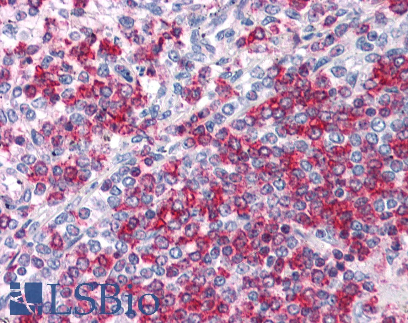 IHC-plus™ APC4 / ANAPC4 Antibody