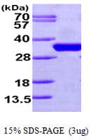 Human CDC34 Protein (Recombinant His)