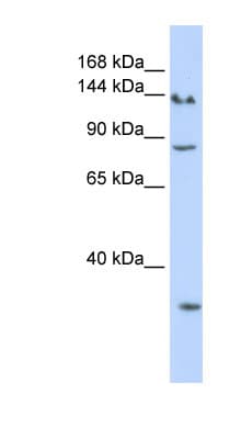 SIN3A Antibody (N-Terminus)