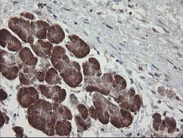 TPD52L3 Antibody (clone OTI4C12, Carrier-free)