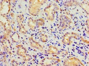 Polyclonal Rabbit anti-Human CBR3 Antibody (aa118-277, IHC, WB)