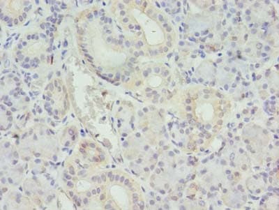 TMEM192 Antibody