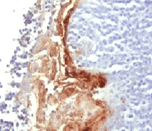 IVL / Involucrin Antibody (clone SY5)
