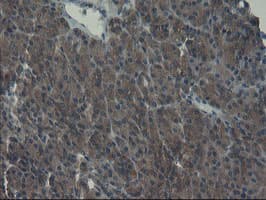 VBP1 Antibody (clone OTI1A5)